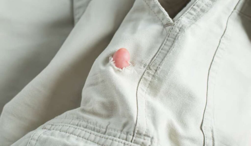 trous vêtements mites